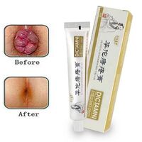 Hua Tuo Herbal Hemorrhoids Cream Chinese Healthy Cream For Internal External Mixed Pain Relief Hemorrhoids Health Care