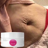 Powerful stretch mark removal Natural organic cream for removing stretch marks