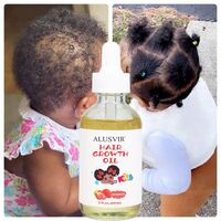 Natural Baby Hair Care Products Super Strong Growth and Nourishing Kids Hair Growth Growth Essence Oil Custom Logo