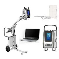 SONTU60 5kw/8kw Wireless Digital Portable X-ray Machine 14*17 FPD