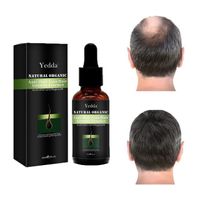 Private Label Hair Scalp Treatment Anti-Hair Loss Regeneration Men's New Hair Treatment Lotion