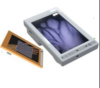 MC401 Easy to use portable vein detector viewer with large LCD screen to display veins at a very low price