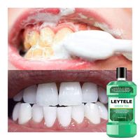 Private Label 250ML Natural Organic Teeth Whitening Oral Care Clean Teeth Green Tea Mouthwash