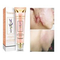 Yoxier Lavender Mark Repair Cream Pigment Correcting Smooth Skin Whitening Scar Care